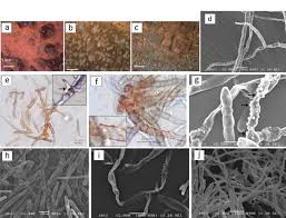 Attēlu rezultāti vaicājumam “Reticularia lobata spores”