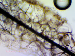 Attēlu rezultāti vaicājumam “Stemonitis fusca var. nigrescens spores”