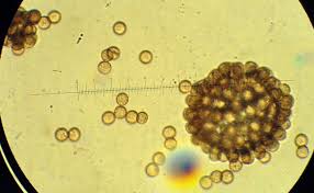 Attēlu rezultāti vaicājumam “Stemonitis splendens spores”