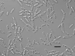 Attēlu rezultāti vaicājumam “Peniophora laurentii”