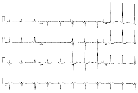 Image result for  ^ L V [ h    