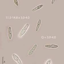 Attēlu rezultāti vaicājumam “Mycosphaerella ulmi”