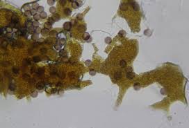 Attēlu rezultāti vaicājumam “Physarum daamsii sessile”