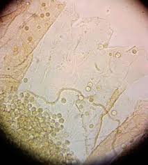 Attēlu rezultāti vaicājumam “Arcyria incarnata young”