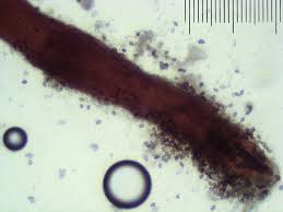 Attēlu rezultāti vaicājumam “Melanospora lagenaria”