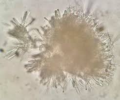 Attēlu rezultāti vaicājumam “Diderma radiatum young”