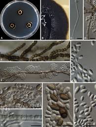 Attēlu rezultāti vaicājumam “Dianema depressum spores”