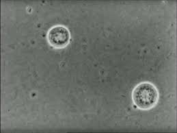 Attēlu rezultāti vaicājumam “Didymium crustaceum plasmodium”