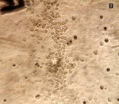 Attēlu rezultāti vaicājumam “Hemitrichia serpula spores”