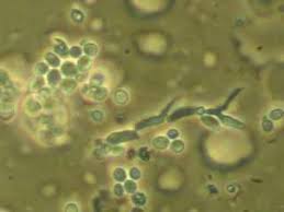 Attēlu rezultāti vaicājumam “Exobasidiales”