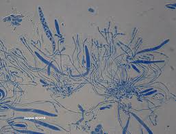 Attēlu rezultāti vaicājumam “Coenogonium pineti”
