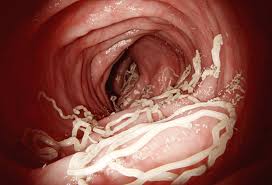 Image result for cestoda excrement dog