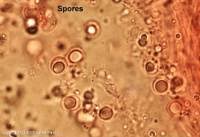 Attēlu rezultāti vaicājumam “Henningsomyces candidus”