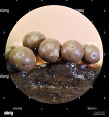 Attēlu rezultāti vaicājumam “Diderma umbilicatum macro”