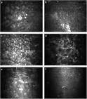 Science Direct.com - Progress in Retinal and Eye Research - Contact ... 