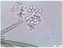 Attēlu rezultāti vaicājumam “Trichia botrytis spores”