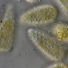 Attēlu rezultāti vaicājumam “Melampsoridium sp.”