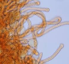 Attēlu rezultāti vaicājumam “Trichia erecta spores”