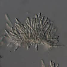 Attēlu rezultāti vaicājumam “Lecanactis abietina”