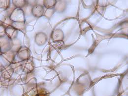 Attēlu rezultāti vaicājumam “Paradiacheopsis sp.”