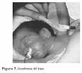 Bolet&Atilde;&shy;n m&Atilde;&copy;dico del Hospital Infantil de M&Atilde;&copy;xico - Mediciones <b>...</b>