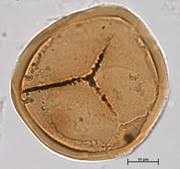 Attēlu rezultāti vaicājumam “Symphytocarpus trechisporus spores”