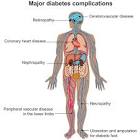 Major <b>Diabetes Complications</b>