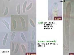 Attēlu rezultāti vaicājumam “Mollisia amenticola”