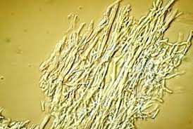 Attēlu rezultāti vaicājumam “Trichia longipalpis spores”