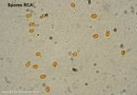 Attēlu rezultāti vaicājumam “Hyphodontia barba-jovis”