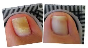 Image result for lunula nail