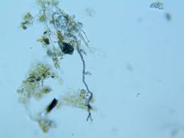 Attēlu rezultāti vaicājumam “Hyaloscypha hyalina”