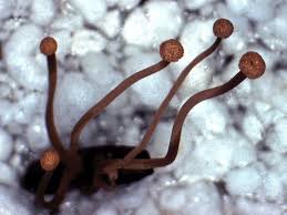 Attēlu rezultāti vaicājumam “Claviceps purpurea”