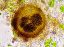 Attēlu rezultāti vaicājumam “Licea pygmaea spores”