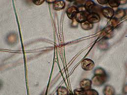 Attēlu rezultāti vaicājumam “Diderma cingulatum”