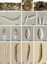 Attēlu rezultāti vaicājumam “Dianema depressum spores”