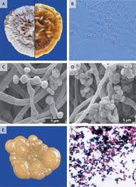 Attēlu rezultāti vaicājumam “Dianema depressum spores”