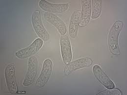 Attēlu rezultāti vaicājumam “Vuilleminia comedens”