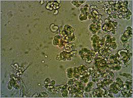 Attēlu rezultāti vaicājumam “Illosporiopsis christiansenii”