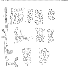 Attēlu rezultāti vaicājumam “Postia rennyi”
