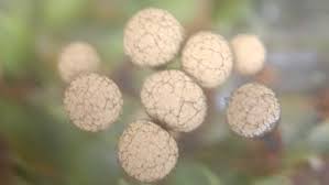 Attēlu rezultāti vaicājumam “Cribraria macrocarpa”