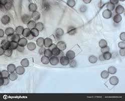 Attēlu rezultāti vaicājumam “Physarum murinum spores”