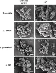 Image result for Myzopsetta ferruginea