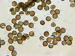 Attēlu rezultāti vaicājumam “Reticularia jurana spores”