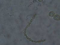 Attēlu rezultāti vaicājumam “Ophiotheca chrysosperma”