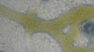 Attēlu rezultāti vaicājumam “Craterium minutum spores”