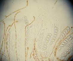 Attēlu rezultāti vaicājumam “Octospora humosa”