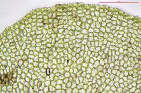 Attēlu rezultāti vaicājumam “Nardia scalaris cells”