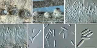 Attēlu rezultāti vaicājumam “Ombrophila violacea spores”