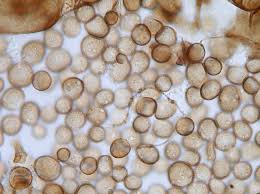 Attēlu rezultāti vaicājumam “Didymium serpula”